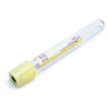 BD Vacutainer ACD Solution B Tube 13 x 100mm 6mL - Box of 100